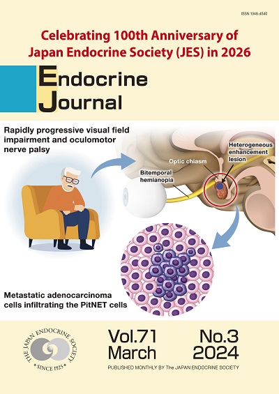 Endocrine Journal Volume: 71  Issue: 3
